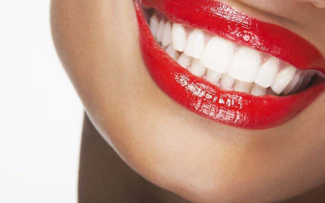 How Can Tooth Whitening Works?
