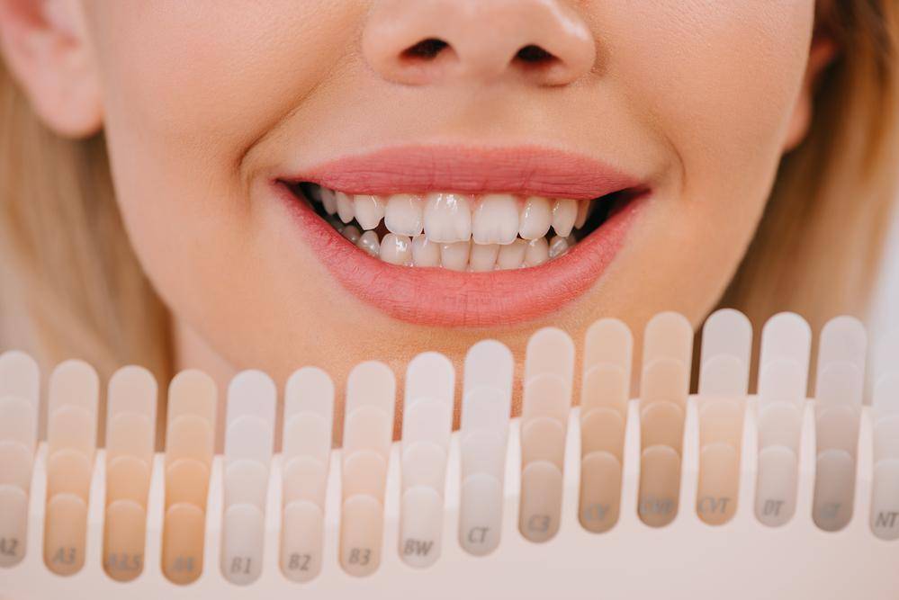 The Magic Of Tooth Whitening!