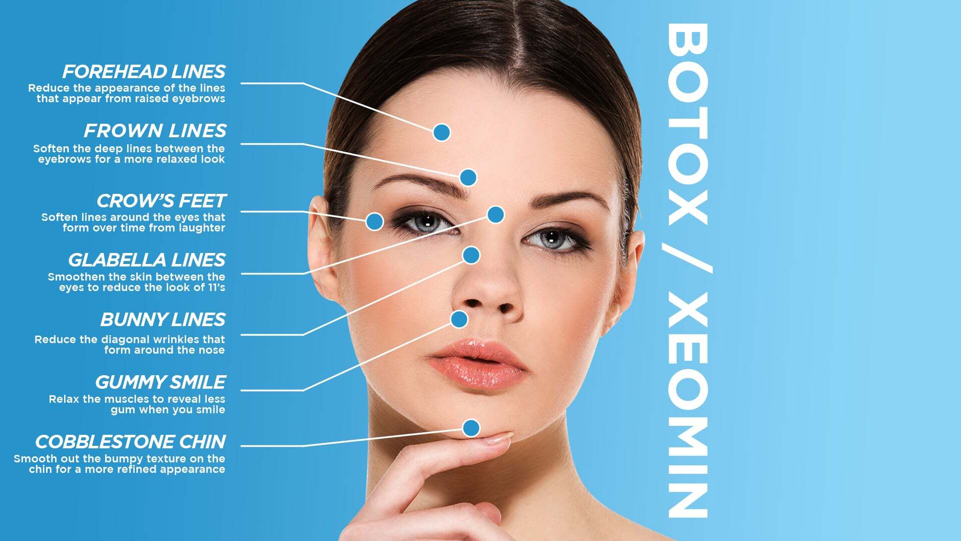 Botox / Xeomin