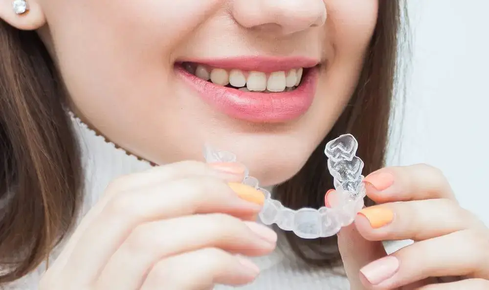 Clear Aligners