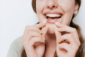 Smile Esthetics | OrthoFX NiTime A Revolutionary Clear Aligner You Only Wear While You Sleep 