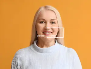 Smile Esthetics | Veneers vs Bonding vs Invisalign  Which is Right for Your Smile Makeover