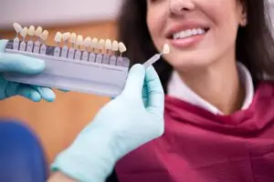 Porcelain Veneers