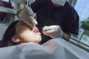 Smile Esthetics | A Thoughtful Approach to Tooth Extractions in Scottsdale