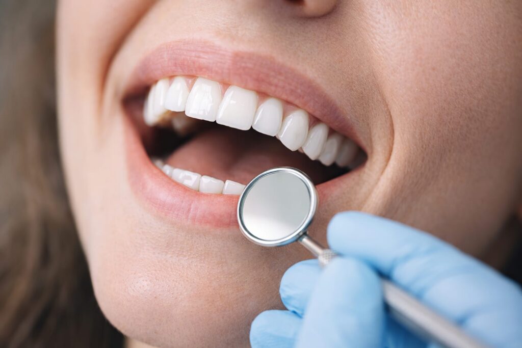 Close up of a dental exam a gloved clinician uses a mouth mirror to inspect a patients open mouth and teeth
